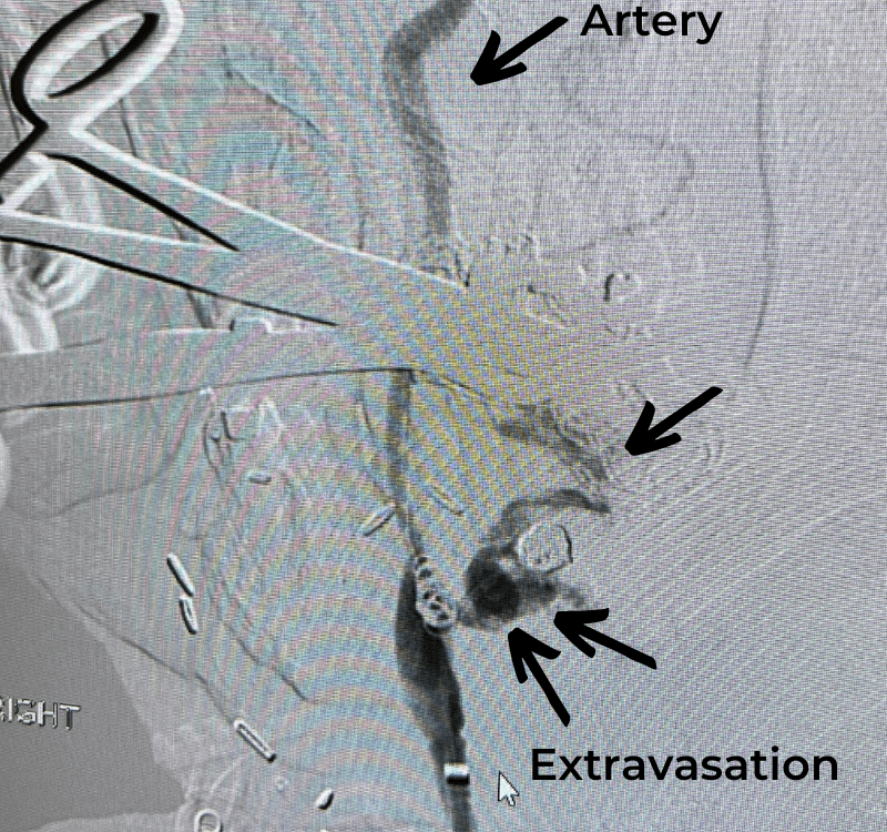 Figure 1 J Brisman new1