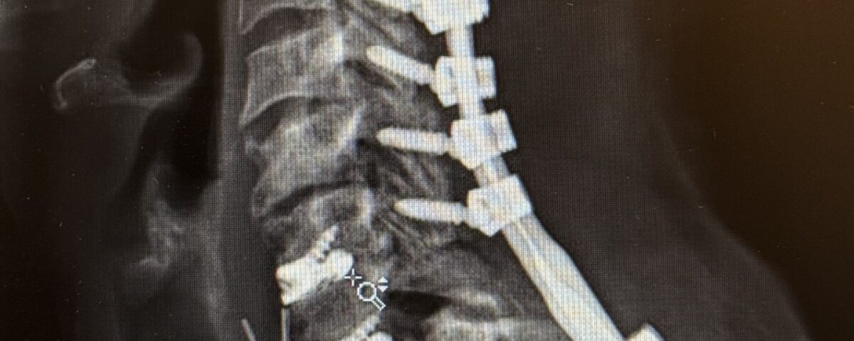 BRC Case Study - Pre-op Photo Fig. 2